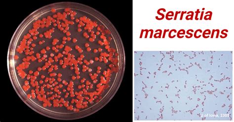 Serratia marcescens .